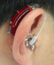 赤色のワイデックス製耳掛け補聴器の画像
