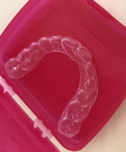 歯列矯正マウスピース(リテーナー)の画像